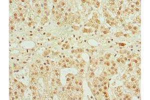 Immunohistochemistry of paraffin-embedded human adrenal gland tissue using ABIN7148657 at dilution of 1:100 (CFDP1 anticorps  (AA 1-299))