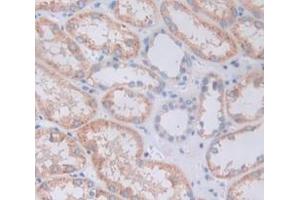 IHC-P analysis of Human Tissue, with DAB staining. (GDF3 anticorps  (AA 251-364))