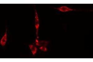 ABIN6275616 staining  CoLo205 cells by IF/ICC.