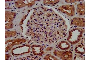 IHC image of ABIN7154230 diluted at 1:1000 and staining in paraffin-embedded human kidney tissue performed on a Leica BondTM system.
