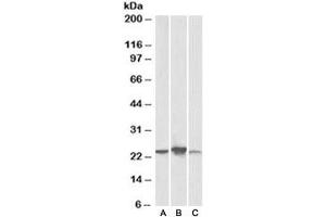 Western blot testing of human [A], mouse [B], rat [C] liver lysate with ABHD14B antibody at 0. (ABHD14B anticorps)