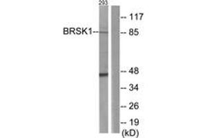 Western blot analysis of extracts from 293 cells, using BRSK1 Antibody. (BRSK1 anticorps  (AA 361-410))