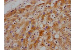 IHC image of ABIN7127528 diluted at 1:100 and staining in paraffin-embedded human liver tissue performed on a Leica BondTM system.