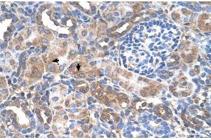 Human kidney (GALNT6 anticorps  (N-Term))