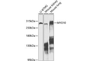 Western blot analysis of extracts of various cell lines, using MYO10 antibody (ABIN6128319, ABIN6144271, ABIN6144274 and ABIN6216113) at 1:1000 dilution. (Myosin X anticorps  (AA 845-944))