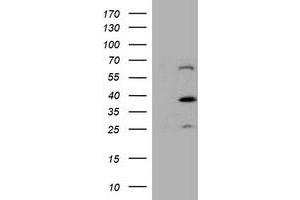 Western Blotting (WB) image for anti-Dystrobrevin, beta (DTNB) antibody (ABIN1497914) (Dystrobrevin beta anticorps)