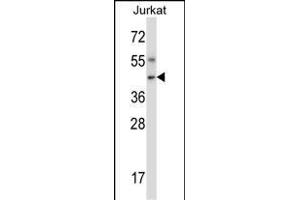 Mouse Nim1 Antibody (C-term) (ABIN657849 and ABIN2846810) western blot analysis in Jurkat cell line lysates (35 μg/lane). (NIM1 anticorps  (C-Term))