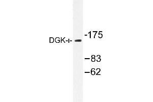 Image no. 1 for anti-Diacylglycerol Kinase, iota (DGKI) antibody (ABIN272146) (DGKI anticorps)