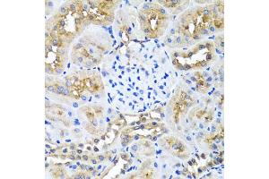 Immunohistochemistry of paraffin-embedded rat kidney using NIN antibody (ABIN5974918) at dilution of 1/100 (40x lens). (Ninein anticorps)