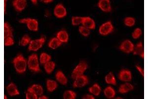 ABIN6278612 staining COLO205 by IF/ICC. (OR51G1 anticorps)