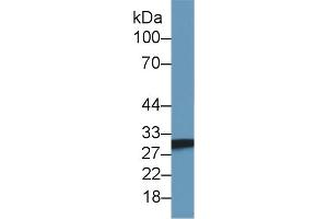 Detection of SDHB in Mouse Skeletal muscle lysate using Polyclonal Antibody to Succinate Dehydrogenase Complex Subunit B (SDHB)