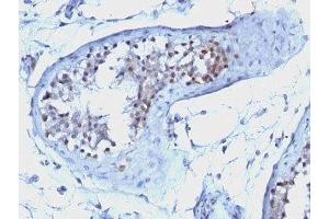 Formalin-fixed, paraffin-embedded human testicular carcinoma stained with Cyclin B1 antibody.
