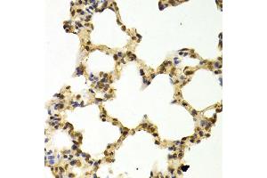 Immunohistochemistry of paraffin-embedded rat lung using DNMT3A Antibody (ABIN1872325) at dilution of 1:100 (40x lens). (DNMT3A anticorps)