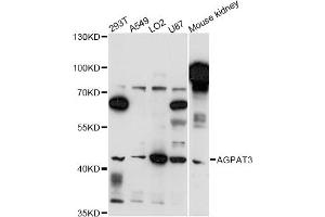 Western blot analysis of extracts of various cell lines, using AGPAT3 antibody (ABIN6291715) at 1:3000 dilution.