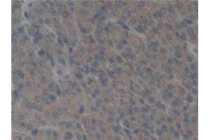 Detection of uPA in Mouse Ovary Tissue using Polyclonal Antibody to Plasminogen Activator, Urokinase (uPA) (PLAU anticorps  (AA 180-433))