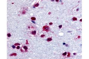 Anti-PYGB antibody IHC of human brain.