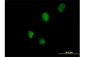 Immunofluorescence of purified MaxPab antibody to RNF113B on HeLa cell. (RNF113B anticorps  (AA 1-322))