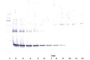 Image no. 2 for anti-Ciliary Neurotrophic Factor (CNTF) antibody (ABIN465749) (CNTF anticorps)