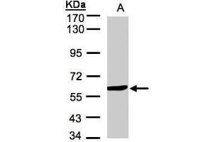 WB Image Sample(30 μg of whole cell lysate) A:Hep G2, 7.