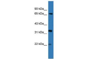 WB Suggested Anti-DOK4  Antibody Titration: 0. (DOK4 anticorps  (N-Term))