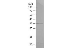 Western Blotting (WB) image for Notch 1 (NOTCH1) (AA 2309-2555) protein (His tag) (ABIN7124195)