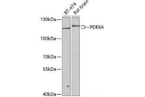 Western blot analysis of extracts of various cell lines using PDE6A Polyclonal Antibody at dilution of 1:1000. (PDE6A anticorps)