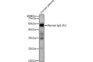 Western blot analysis of extracts of Human plasma, using Human IgG antibody (ABIN7267844) at 1:3000 dilution.