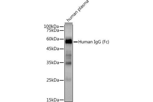IGHG1 anticorps