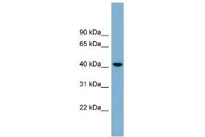 WB Suggested Anti-B4GALT2 Antibody Titration:  0. (B4GALT2 anticorps  (Middle Region))
