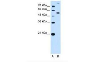Image no. 2 for anti-Phosphoribosyl Pyrophosphate Amidotransferase (PPAT) (AA 51-100) antibody (ABIN6738207) (PPAT anticorps  (AA 51-100))