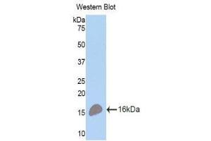 Western Blotting (WB) image for anti-Tumor Necrosis Factor Receptor Superfamily, Member 17 (TNFRSF17) (AA 71-184) antibody (ABIN1173606) (BCMA anticorps  (AA 71-184))