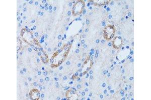 Immunohistochemistry of paraffin-embedded Rat kidney using LDLRAP1 Polyclonal Antibody at dilution of 1:100 (40x lens).
