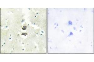 Immunohistochemistry analysis of paraffin-embedded human brain tissue, using BRI3B Antibody. (BRI3BP anticorps  (AA 1-50))