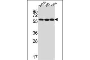 Western blot analysis of UTP6 Antibody (N-term) (ABIN651489 and ABIN2840264) in Jurkat,293,Hela cell line lysates (35 μg/lane). (UTP6 anticorps  (N-Term))