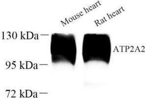 Western blot analysis of ATP2A2 (ABIN7075545) at dilution of 1: 500 (SERCA2 ATPase anticorps)