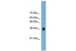 FRZB antibody used at 0. (FRZB anticorps  (Middle Region))