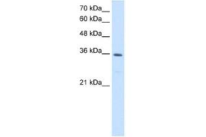 MTHFD2 antibody used at 1. (MTHFD2 anticorps)