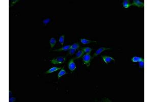 Immunofluorescent analysis of Hela cells using ABIN7173207 at dilution of 1:100 and Alexa Fluor 488-congugated AffiniPure Goat Anti-Rabbit IgG(H+L) (CNPY2/MSAP anticorps  (AA 1-129))