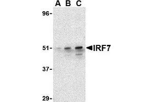 Western blot analysis of IRF7 in 293 whole cell lysate with AP30449PU-N IRF7 antibody at (A) 0.
