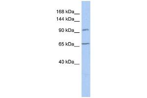 WB Suggested Anti-COG5 Antibody Titration:  0. (COG5 anticorps  (N-Term))