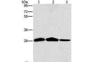 Western Blot analysis of Mouse liver and Human chromaffin cell tumor tissue, hepG2 cell using SPR Polyclonal Antibody at dilution of 1:1500 (SPR anticorps)