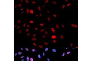 Immunofluorescence analysis of U2OS cells using Phospho-SMC1A(S957) Polyclonal Antibody