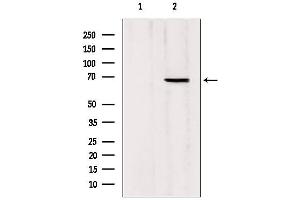 Western blot analysis of extracts from Mouse Myeloma cell, using MTA3 antibody. (MTA3 anticorps  (Internal Region))