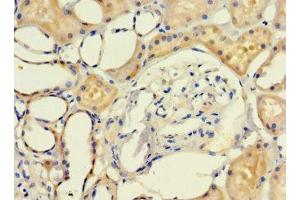 Immunohistochemistry of paraffin-embedded human kidney tissue using ABIN7158049 at dilution of 1:100 (LRCH1 anticorps  (AA 1-105))