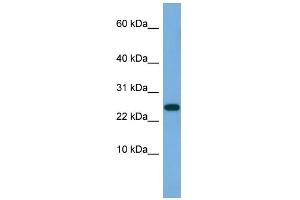 WB Suggested Anti-ANKRD39 Antibody Titration: 0. (ANKRD39 anticorps  (N-Term))