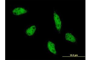 Immunofluorescence of monoclonal antibody to TFAP2B on HeLa cell.