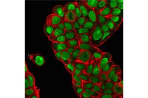 Immunofluorescence Analysis of PFA-fixed MCF-7 cells stained with Nucleolin MAb (364-5 + NCL/902) followed by Goat anti-Mouse IgG-CF488 (Green). (Nucleolin anticorps)