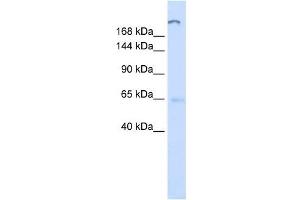 ATP10D antibody used at 1 ug/ml to detect target protein. (ATP10D anticorps  (C-Term))