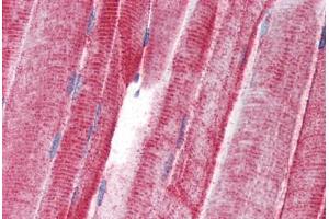 Human Skeletal Muscle (formalin-fixed, paraffin-embedded) stained with UNC93B antibody ABIN343917 at 5 ug/ml followed by biotinylated goat anti-rabbit IgG secondary antibody ABIN481713, alkaline phosphatase-streptavidin and chromogen. (UNC93B1 anticorps  (N-Term))