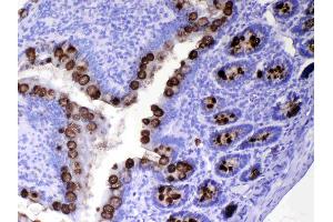 IHC analysis of TFF3 using anti-TFF3 antibody .